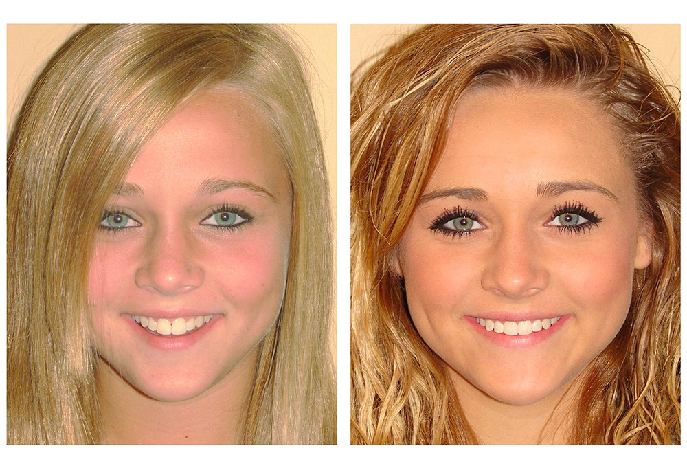 Lake Minneola Dentistry