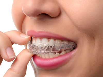 The image shows a person with a clear, straight smile, holding what appears to be a dental retainer or orthodontic appliance in their hand.