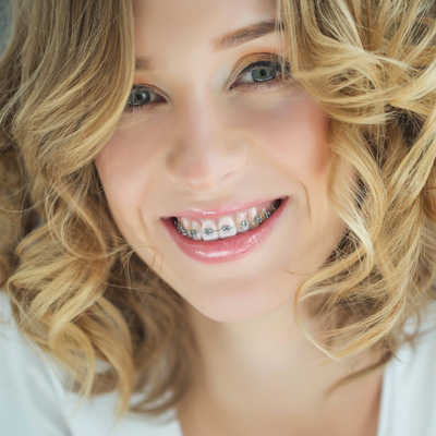 A woman with straight teeth and a radiant smile, wearing braces.