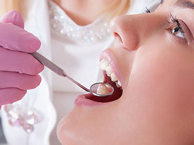 An image of a dental professional performing oral care on a patient, with the patient's mouth open and the dentist using a dental tool.